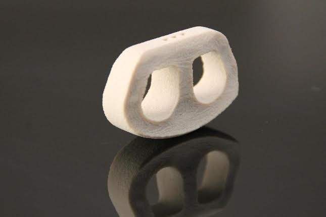 Tulang Punggung Hasil Printer 3D ngelag.com